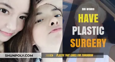 Did Wonho Undergo Plastic Surgery? Unveiling the Truth Behind the Rumors