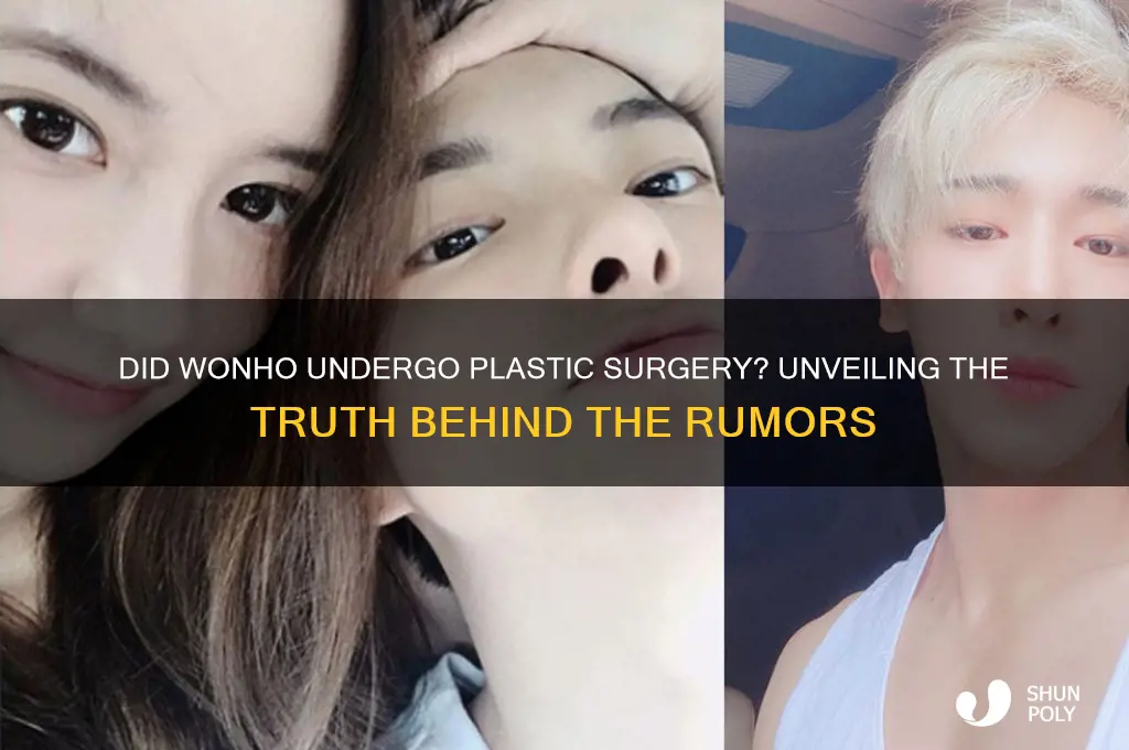 did wonho have plastic surgery