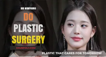 Wonyoung's Transformation: Plastic Surgery Rumors and the Truth Behind Them