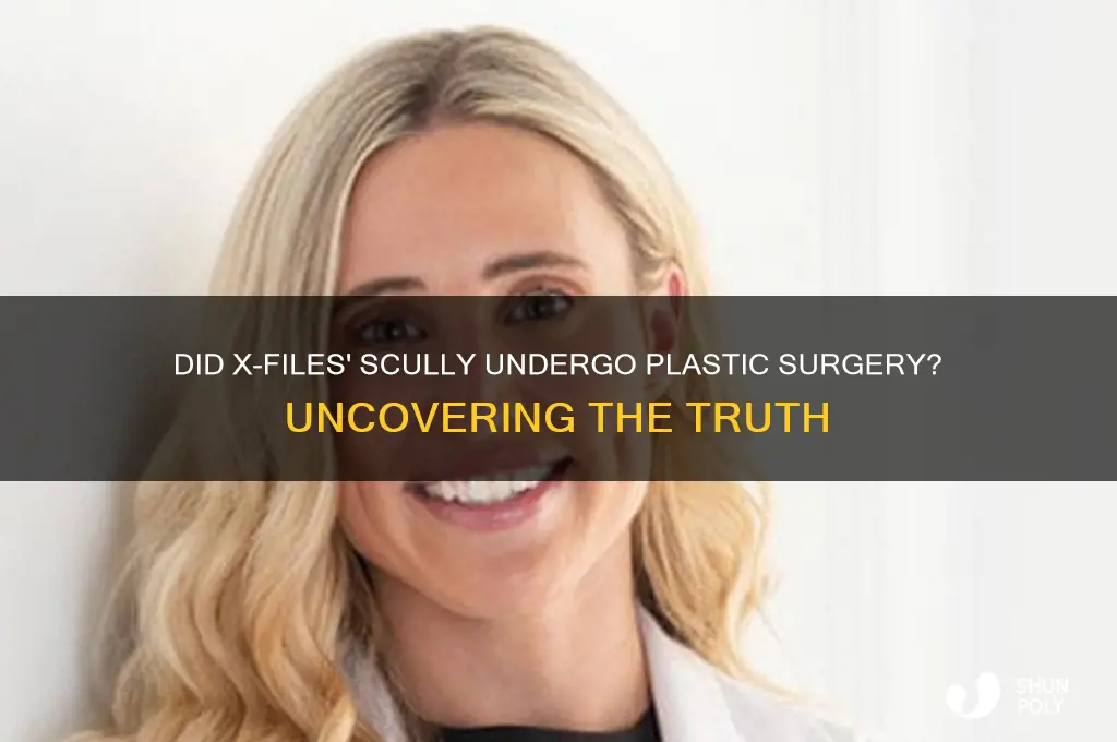 did xfiles skully have plastic surgery