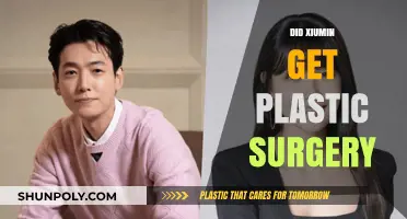 Xiumin's Transformation: Plastic Surgery Rumors and the Truth Behind Them