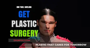 Yael Shelbia's Transformation: Plastic Surgery Rumors Explored and Debunked