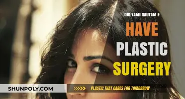 Yami Gautam's Transformation: Plastic Surgery Rumors Explored and Debunked