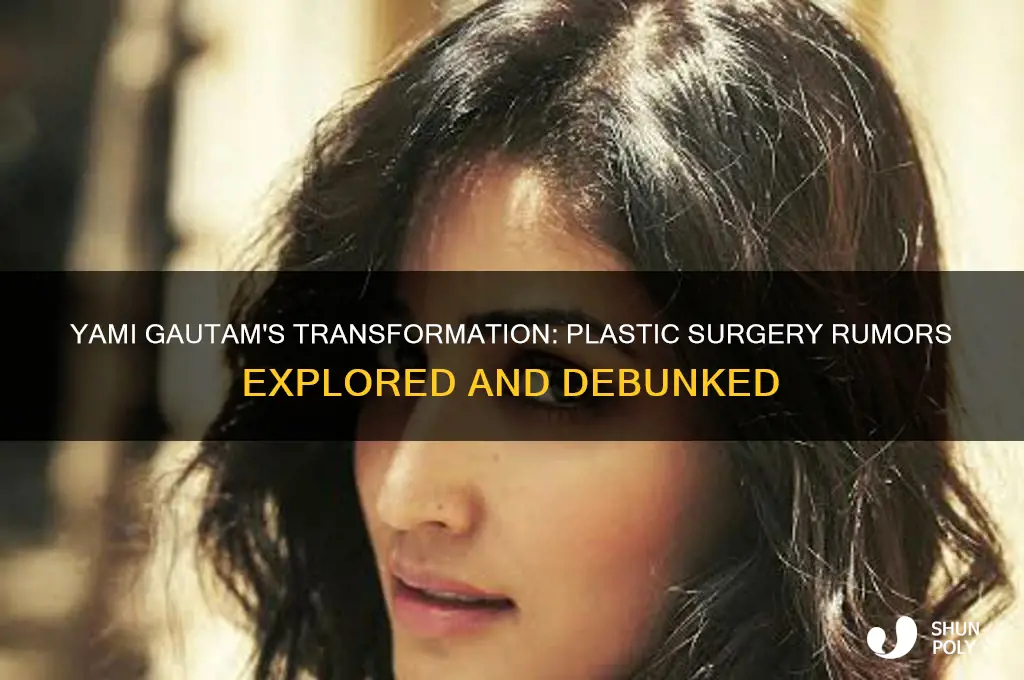 did yami gautam e have plastic surgery