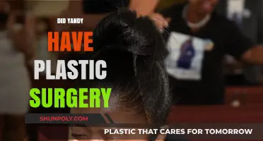 Did Yandy Get Plastic Surgery? Uncovering the Truth Behind Her Look