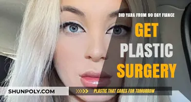 Yara's Transformation: Plastic Surgery Rumors on 90 Day Fiancé Explored