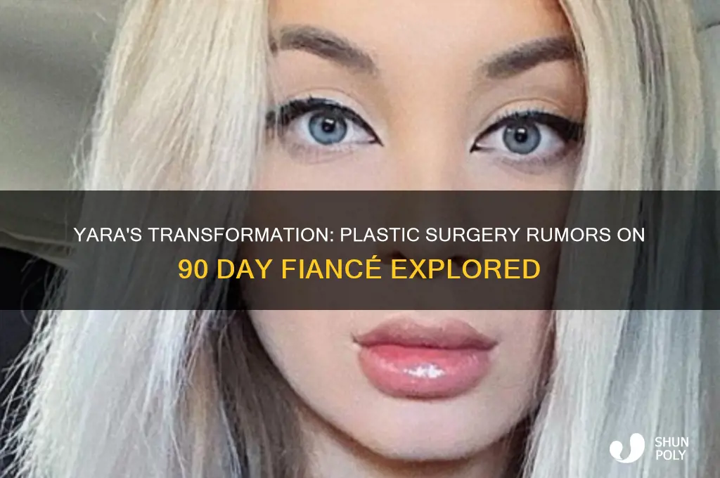 did yara from 90 day fiance get plastic surgery