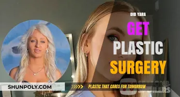 Did Yara Undergo Plastic Surgery? Unveiling the Truth Behind Her Transformation