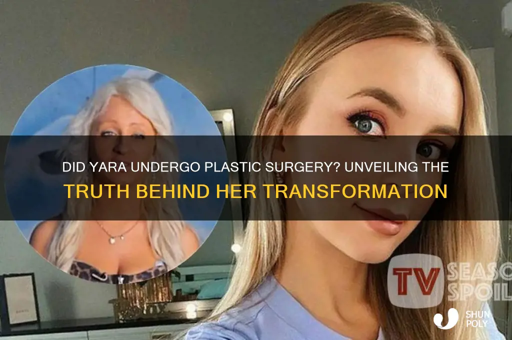 did yara get plastic surgery