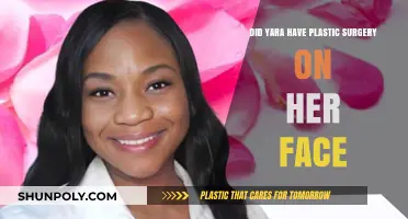 Yara's Transformation: Unveiling the Truth About Her Facial Surgery