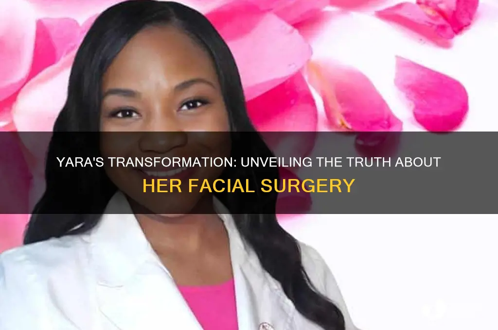 did yara have plastic surgery on her face