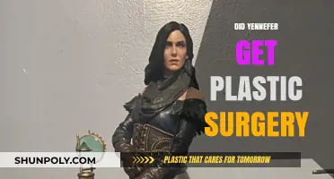 Yennefer's Transformation: Plastic Surgery Rumors and the Truth Behind Her Look