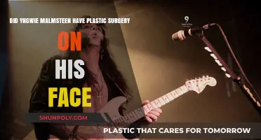 Yngwie Malmsteen's Face: Plastic Surgery Rumors Explored