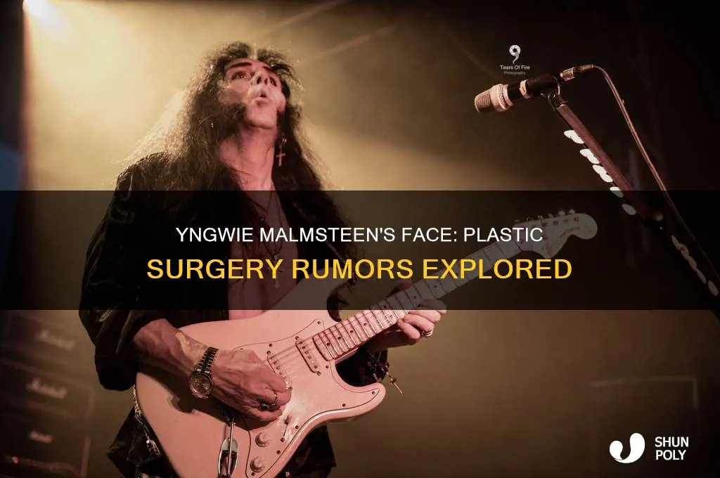 did yngwie malmsteen have plastic surgery on his face