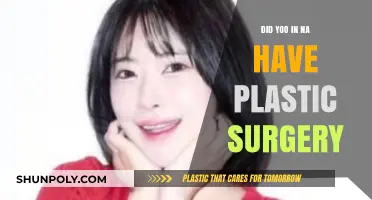 Yoo In Na's Transformation: Plastic Surgery Rumors Explored