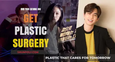 Yoo Seung Ho Plastic Surgery: Fact-Checking the Rumors and Speculations