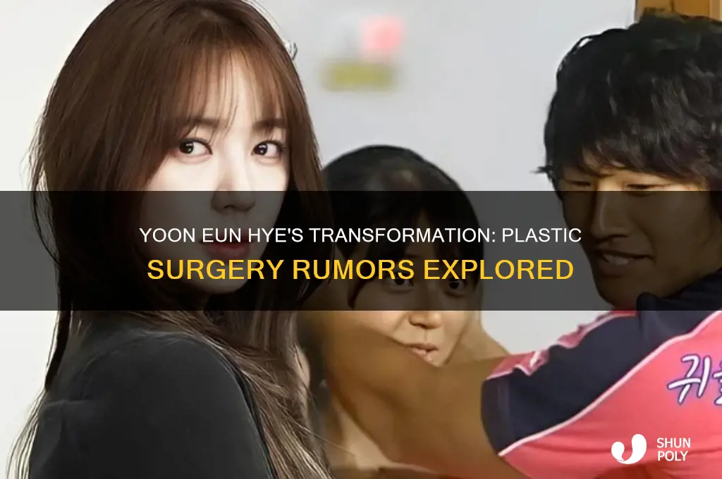 did yoon eun hye get plastic surgery
