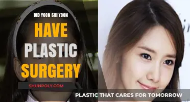Yoon Shi Yoon Plastic Surgery: Fact or Fiction?
