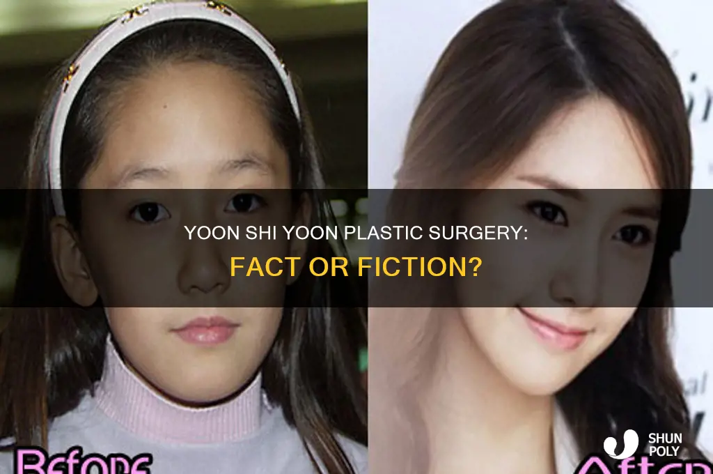 did yoon shi yoon have plastic surgery