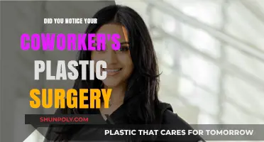 Coworker's Transformation: Noticing Their Plastic Surgery Without Crossing Boundaries