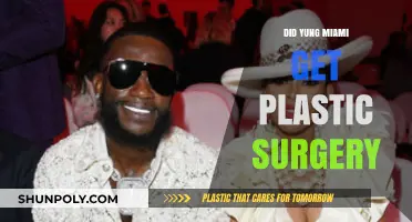 Yung Miami's Transformation: Plastic Surgery Rumors and Reality Revealed
