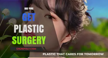 Did Yuri Undergo Plastic Surgery? Uncovering the Truth Behind the Rumors