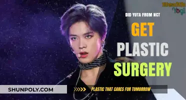 Yuta's Transformation: Plastic Surgery Rumors and NCT's Visual Evolution
