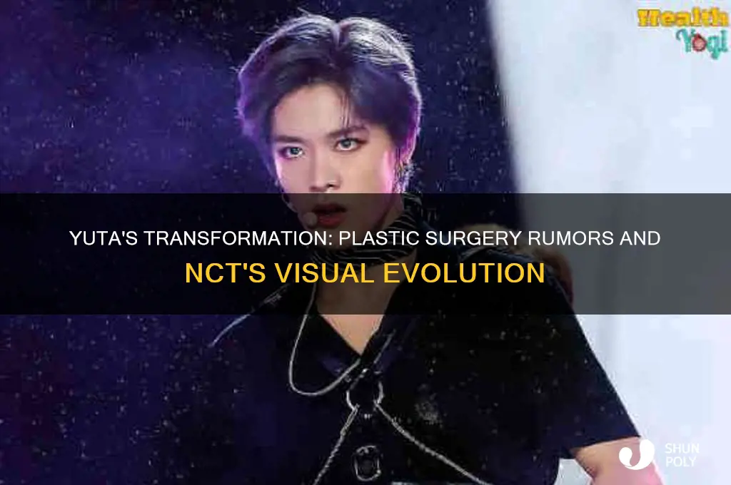 did yuta from nct get plastic surgery