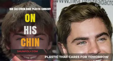 Zac Efron's Chin Transformation: Plastic Surgery or Natural Change?
