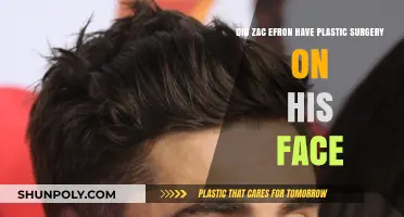 Zac Efron's Face Transformation: Plastic Surgery Rumors Explored
