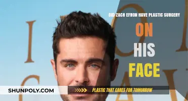Zach Efron's Face Transformation: Plastic Surgery Rumors Explored