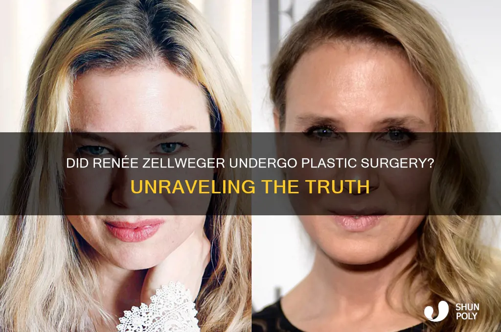 did zellweger really get plastic surgery