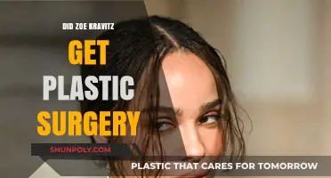 Zoe Kravitz Plastic Surgery Rumors: Fact-Checking Her Natural Beauty