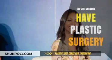 Zoe Saldana's Transformation: Plastic Surgery Rumors Explored and Debunked