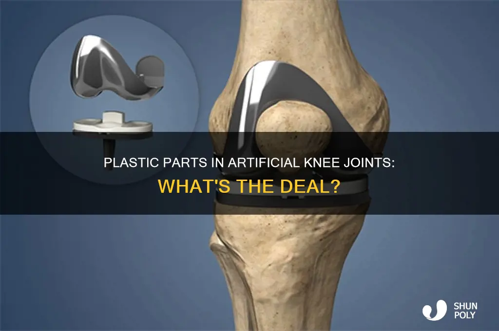 do all artificial knee joints contain plastic parts