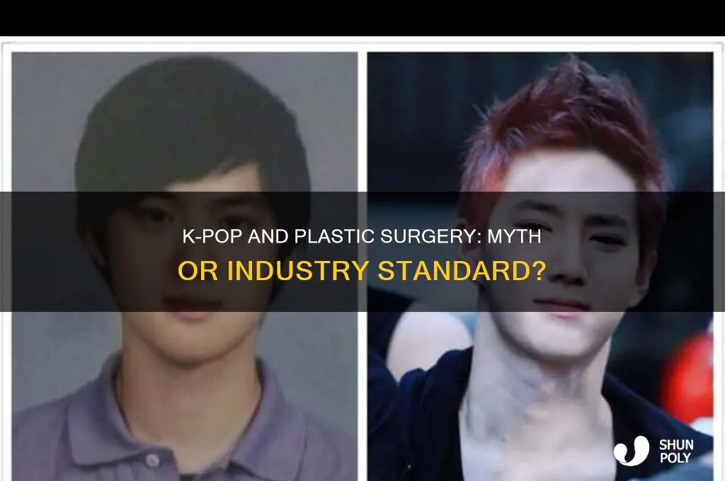 do all kpop have plastic surgery
