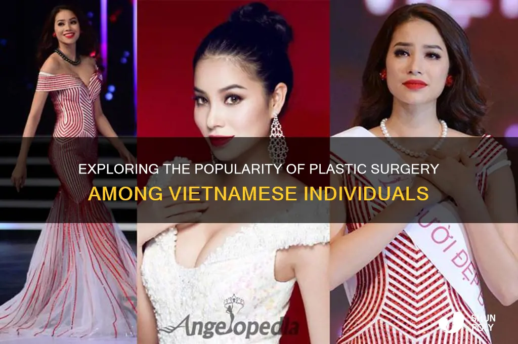 do alot of vietbamese do plastic surgery