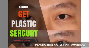 Exploring the Rising Trend of Plastic Surgery Among Asians