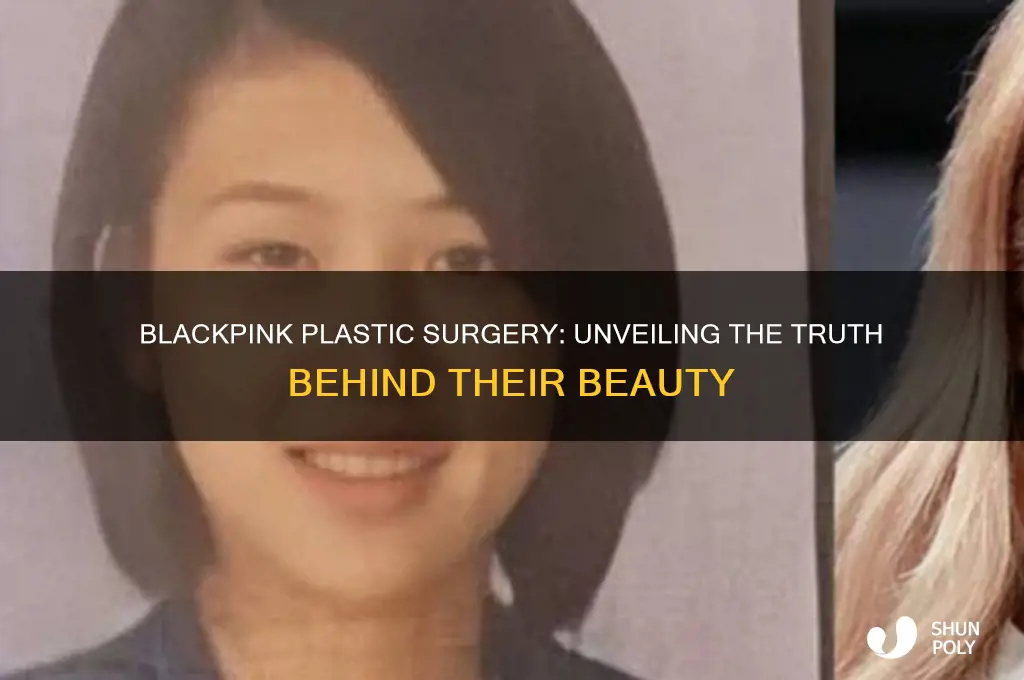 do blackpink get plastic surgery
