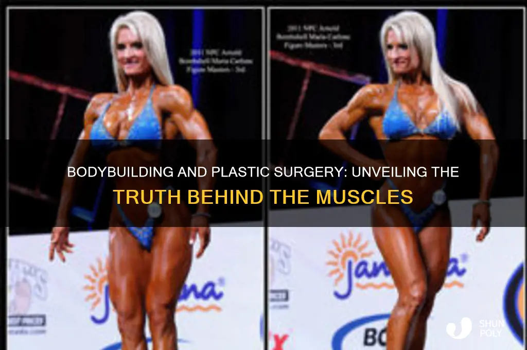 do bodybuilders get plastic surgery