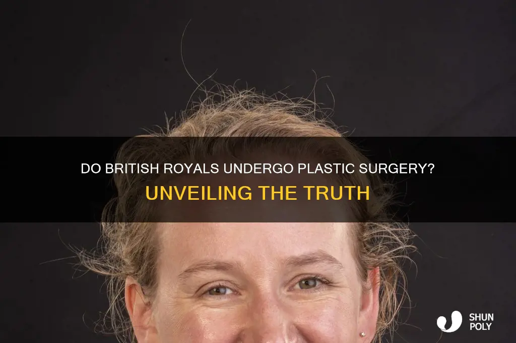 do british royals get plastic surgery