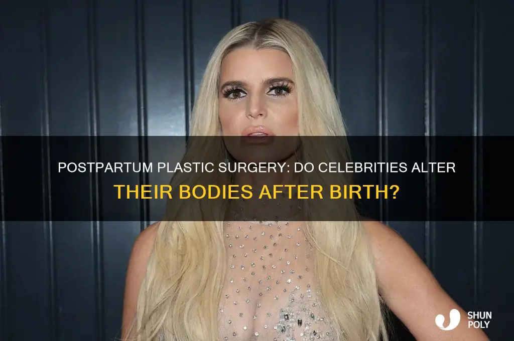 do celebrities have plastic surgery after giving birth