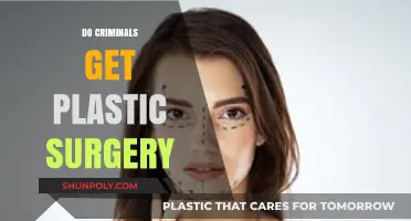 Do Criminals Undergo Plastic Surgery to Evade Justice and Reinvent Themselves?