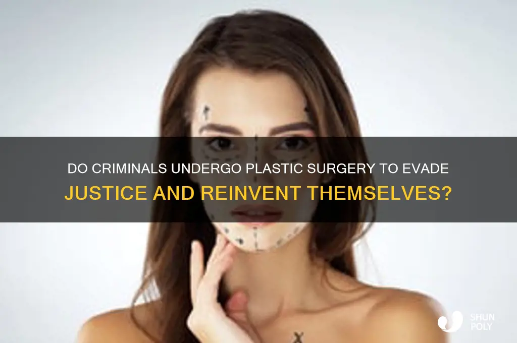 do criminals get plastic surgery