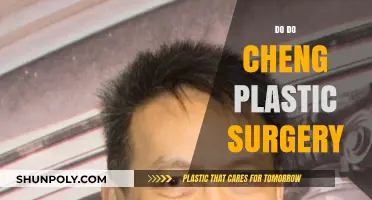 Did Do Do Cheng Undergo Plastic Surgery? Unveiling the Truth
