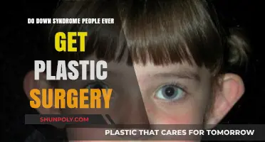 Plastic Surgery for Down Syndrome Individuals: Exploring Options and Considerations