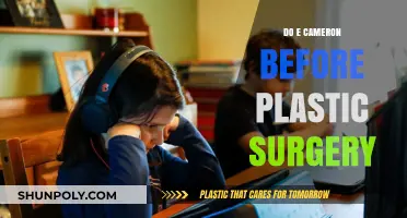 Unveiling E. Cameron's Pre-Plastic Surgery Transformation: A Candid Look