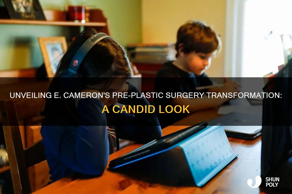 do e cameron before plastic surgery