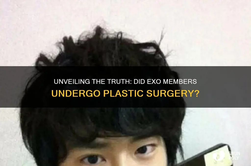 do exo plastic surgery