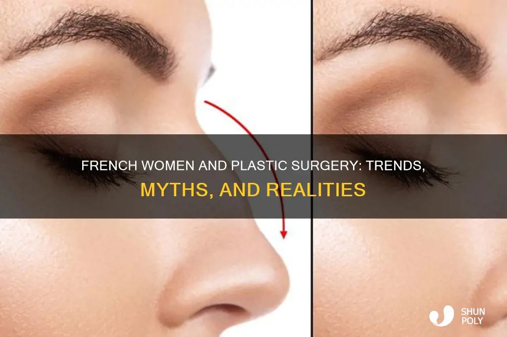 do french women get plastic surgery